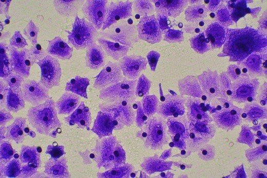 细胞迁移/Transwell