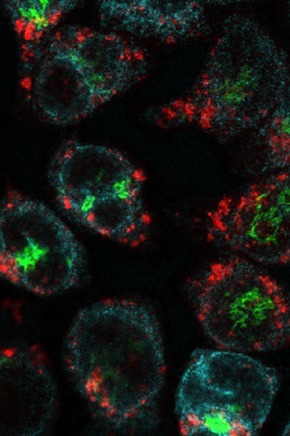 成像激光扫描共聚焦系统