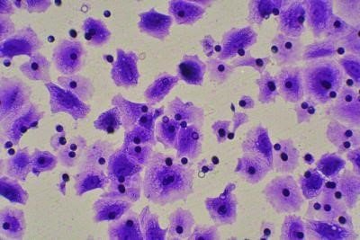 细胞迁移/Transwell