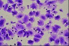 细胞迁移/Transwell