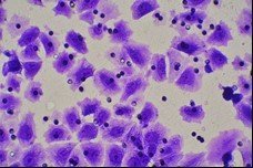 细胞迁移/Transwell