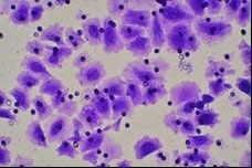 细胞迁移/Transwell