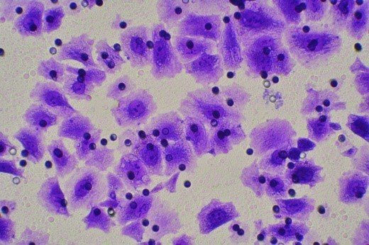 细胞迁移/Transwell