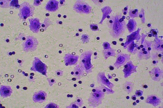 细胞迁移/Transwell