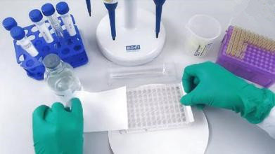 小鼠缺血修饰白蛋白(IMA)ELISA试剂盒