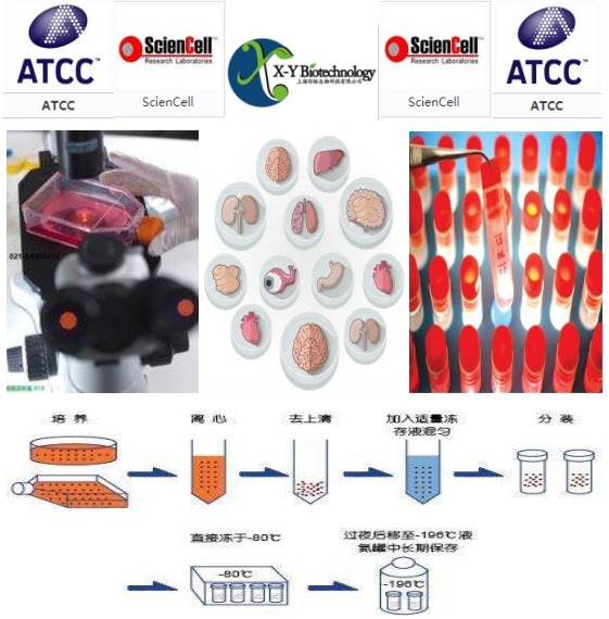ECA109(ECA-109);人食管癌细胞
