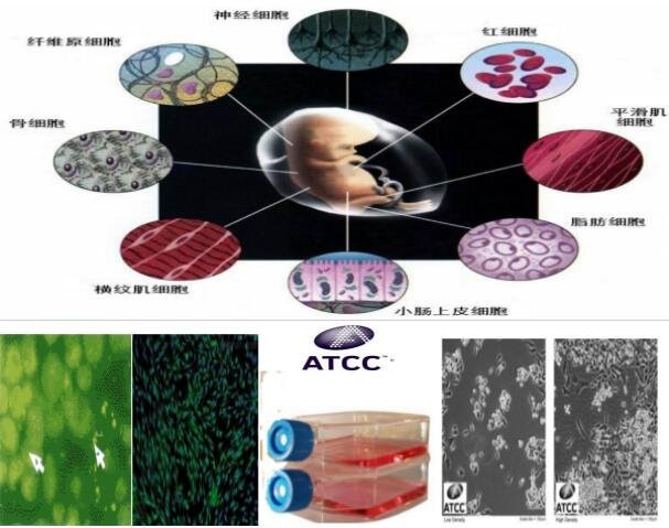 EC9706(人食管癌细胞)