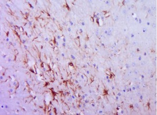 A型流感病毒H5N1凝集素免疫荧光抗体