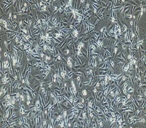 人肾透明细胞癌细胞，786-O(786-0)