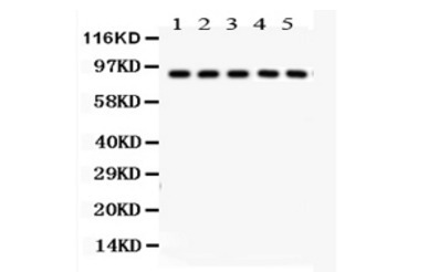 ALR肝再生增强因子抗体