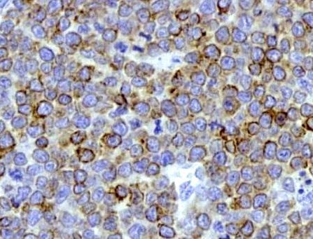 代做免疫组化实验