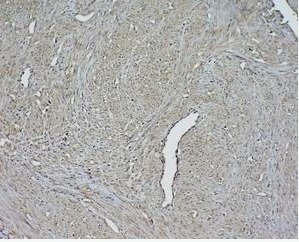 β-肌动蛋白/β-Actin 抗体（内参抗体）