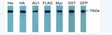 重组16标签蛋白，Recombinant 16-Tag Pr