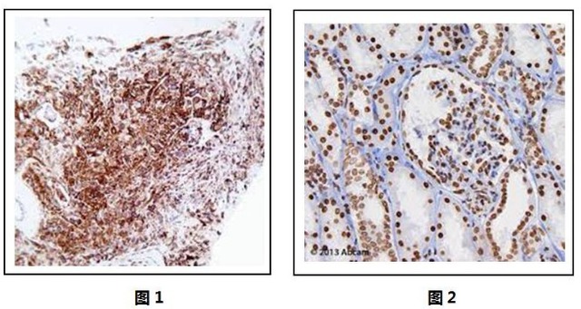 X-连锁釉原蛋白(AMELX)免疫组化试剂盒人样本检测